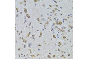Immunohistochemistry of paraffin-embedded rat brain using RPL13 Antibody (ABIN2559760) at dilution of 1:100 (40x lens). (RPL13 Antikörper)