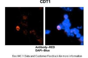 HC Suggested Anti-CDT1 antibody Titration:2 ug/ml Positive Control:Mouse brain stem cells (CDT1 Antikörper  (C-Term))
