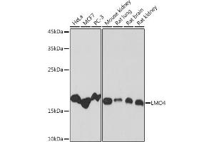 Western blot analysis of extracts of various cell lines, using LMO4 Rabbit mAb (ABIN7268258) at 1:1000 dilution. (LMO4 Antikörper)