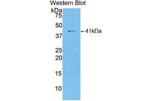 Detection of recombinant MDC using Polyclonal Antibody to Macrophage Derived Chemokine (MDC) (CCL22 Antikörper  (AA 25-93))