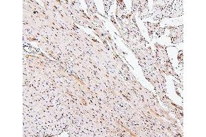 IHC analysis of PPCS using anti-PPCS antibody (ABIN7602752).