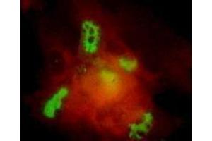 Immunofluorescence (IF) image for anti-Varicella Zoster Virus ORF62 (VZV IE62) antibody (ABIN265612) (Varicella Zoster Virus ORF62 (VZV IE62) Antikörper)