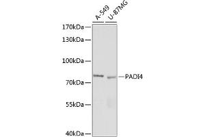 Western blot analysis of extracts of various cell lines, using P antibody (ABIN7269207) at 1:1000 dilution.