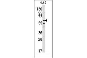 Image no. 1 for anti-V-Yes-1 Yamaguchi Sarcoma Viral Related Oncogene Homolog (LYN) (N-Term) antibody (ABIN359987) (LYN Antikörper  (N-Term))