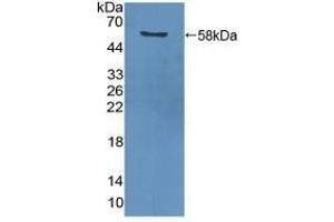 Western blot analysis of recombinant Human PCNA. (PCNA Antikörper  (AA 6-261))