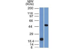 Western Blot Analysis (A) Recombinant Protein(B) Raji cell lysate UsingPAX8 Mouse Monoclonal Antibody (PAX8/1491). (PAX8 Antikörper  (AA 60-261))