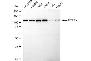 anti-MTREX antibody