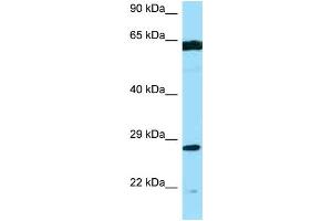 WB Suggested Anti-PMM2 AntibodyTitration: 1. (PMM2 Antikörper  (Middle Region))