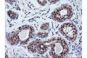 Immunohistochemical staining of paraffin-embedded Human breast tissue using anti-TIMP2 mouse monoclonal antibody. (TIMP2 Antikörper)