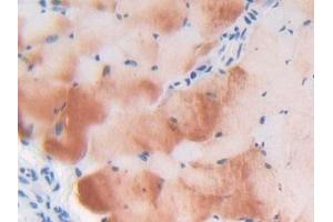 Immunohistochemistry (IHC) image for anti-Latent Transforming Growth Factor beta Binding Protein 1 (LTBP1) (AA 1415-1712) antibody (ABIN7440761)