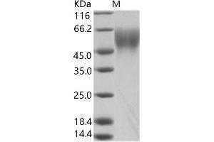Western Blotting (WB) image for Zaire Ebola Virus Envelope Glycoprotein (ZEBOV GP) protein (ABIN7198929) (ZEBOV GP Protein)