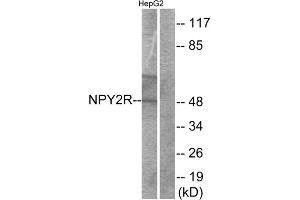 Western blot analysis of extracts from HepG2 cells, using NPY2R antibody. (NPY2R Antikörper  (N-Term))