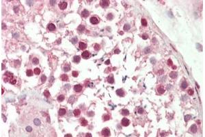 Immunohistochemistry (IHC) image for anti-Nuclear Factor of Activated T-Cells, Cytoplasmic, Calcineurin-Dependent 4 (NFATC4) (N-Term) antibody (ABIN6754931)