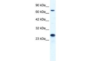 MCM6 antibody used at 1.
