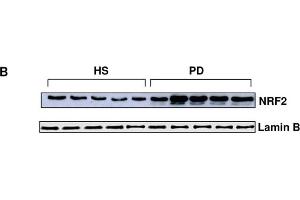 Western Blotting (WB) image for anti-Nuclear Factor (erythroid-Derived 2)-Like 2 (NFE2L2) (Internal Region) antibody (ABIN2855612)