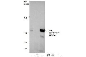 IP Image Immunoprecipitation of DNA polymerase gamma protein from MCF-7 whole cell extracts using 5 μg of DNA polymerase gamma antibody, Western blot analysis was performed using DNA polymerase gamma antibody, EasyBlot anti-Rabbit IgG  was used as a secondary reagent. (POLG Antikörper  (C-Term))