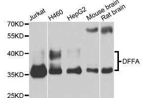 Western blot analysis of extracts of various cell lines, using DFFA antibody. (DFFA Antikörper)