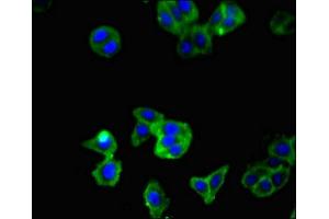 Immunofluorescent analysis of HepG2 cells using ABIN7177979 at dilution of 1:100 and Alexa Fluor 488-congugated AffiniPure Goat Anti-Rabbit IgG(H+L)