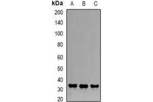 Western blot analysis of Emerin expression in Hela (A), Jurkat (B), PC3 (C) whole cell lysates. (Emerin Antikörper)