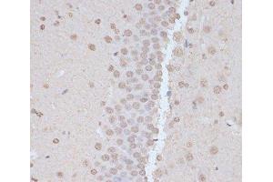 Immunohistochemistry of paraffin-embedded Rat brain using Phospho-PRKAA1(T183)/PRKAA2(T172) Polyclonal Antibody at dilution of 1:100 (40x lens). (PRKAA1 Antikörper  (pThr172, pThr183))