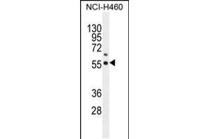 Western blot analysis in NCI-H460 cell line lysates (35ug/lane). (COQ6 Antikörper  (N-Term))