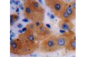 IHC-P analysis of Liver tissue, with DAB staining. (ADH1 Antikörper  (AA 169-370))
