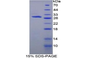 SDS-PAGE analysis of Rat Protein S Protein. (PROS1 Protein)