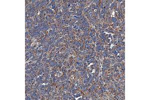 IHC analysis of SETD3 using anti-SETD3 antibody (ABIN7600293).