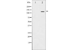 Western blot analysis of Integrin beta3 expression in NIH-3T3 whole cell lysates,The lane on the left is treated with the antigen-specific peptide. (Integrin beta 3 Antikörper  (C-Term))