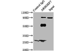 Immunoprecipitating ARHGEF7 in Hela whole cell lysate Lane 1: Rabbit control IgG (1 μg) instead of ABIN7167994 in Hela whole cell lysate. (ARHGEF7 Antikörper  (AA 1-250))