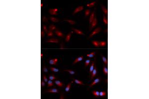 Immunofluorescence analysis of U2OS cells using ADAM9 antibody (ABIN5973121). (ADAM9 Antikörper)