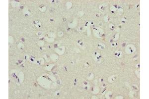 Immunohistochemistry (IHC) image for anti-Potassium Voltage-Gated Channel, Shal-Related Subfamily, Member 1 (Kcnd1) (AA 410-647) antibody (ABIN7163973)