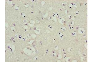 Immunohistochemistry of paraffin-embedded human brain tissue using ABIN7163973 at dilution of 1:100 (KCND1 Antikörper  (AA 410-647))