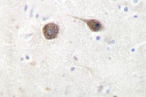 Image no. 1 for anti-C-Jun-Amino-Terminal Kinase-Interacting Protein 2 (JIP-2) antibody (ABIN272223) (IB2 Antikörper)