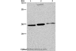Western blot analysis of A375, 293T and SKOV3 cell, using PITX2 Polyclonal Antibody at dilution of 1:250 (PITX2 Antikörper)