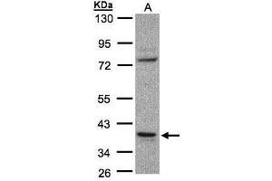 WB Image Sample(30 ug whole cell lysate) A:Raji , 10% SDS PAGE antibody diluted at 1:1000 (CCDC68 Antikörper)