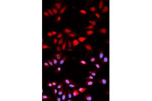 Immunofluorescence (IF) image for anti-Regulator of Calcineurin 1 (RCAN1) antibody (ABIN1876514) (RCAN1 Antikörper)