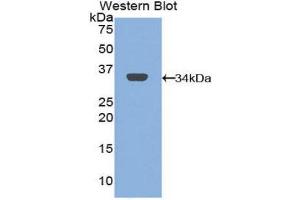 Western Blotting (WB) image for anti-Mannose Receptor, C Type 1 (MRC1) (AA 225-492) antibody (ABIN1859879)
