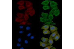 ABIN6257907 and ABIN6275041 staining Hela cells(45 min of heat-shock) by IF/ICC. (HSD11B1 Antikörper  (N-Term))