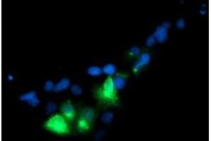 Immunofluorescence (IF) image for anti-Golgi Membrane Protein 1 (GOLM1) antibody (ABIN1498494)