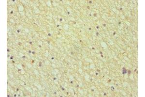 Immunohistochemistry of paraffin-embedded human brain tissue using ABIN7144027 at dilution of 1:100 (Amphiphysin Antikörper  (AA 340-620))