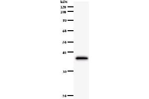 Western Blotting (WB) image for anti-Cbl Proto-Oncogene B, E3 Ubiquitin Protein Ligase (CBLB) antibody (ABIN933045) (Cbl Proto-Oncogene B, E3 Ubiquitin Protein Ligase (CBLB) Antikörper)