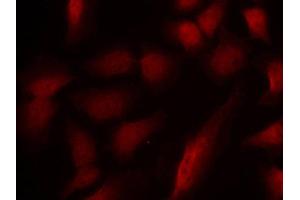 Immunofluorescence staining of methanol-fixed Hela cells using using Phospho-GATA1-S310 antibody. (GATA1 Antikörper  (pSer310))