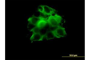 Immunofluorescence of monoclonal antibody to CCT2 on A-431 cell. (CCT2 Antikörper  (AA 117-217))