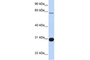 RALGPS1 antibody used at 1 ug/ml to detect target protein. (RALGPS1 Antikörper  (Middle Region))