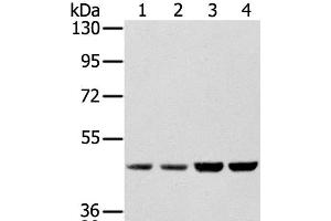 Western Blot analysis of Hela, Raji, 231 and K562 cell using SSB Polyclonal Antibody at dilution of 1:400 (SSB Antikörper)