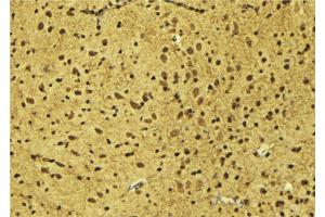 ABIN6275194 at 1/100 staining Mouse brain tissue by IHC-P. (Msx2/Hox8 Antikörper  (Internal Region))