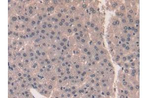 Used in DAB staining on fromalin fixed paraffin- embedded liver tissue (Midkine Antikörper  (AA 22-140))