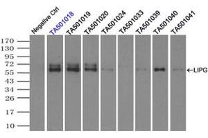 Image no. 8 for anti-Lipase, Endothelial (LIPG) antibody (ABIN1499165)