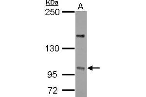Western Blotting (WB) image for anti-Protein Phosphatase 4, Regulatory Subunit 4 (PPP4R4) (C-Term) antibody (ABIN1491842) (PPP4R4 Antikörper  (C-Term))